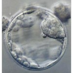 A Human Blastocyst Copyright J. Pabon collection